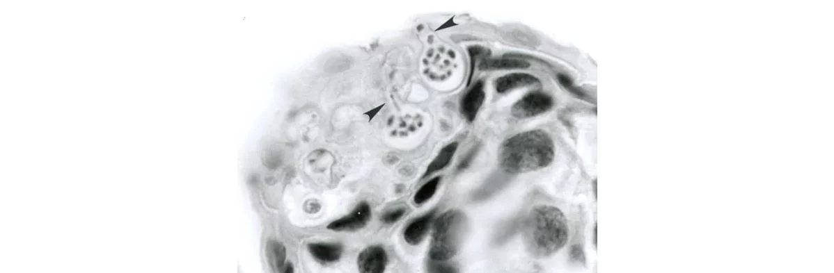 Une spore de chytridiomycose vue au microscope.